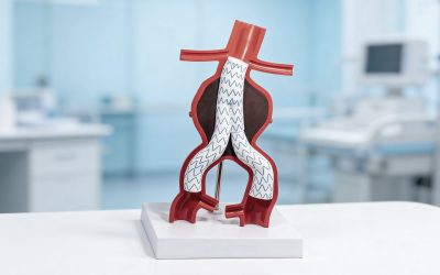 إصلاح تمدد الشريان الأورطي